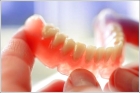 Зубной протез Vertex