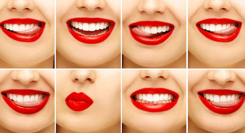 Секрет голливудской улыбки! Скидка 56% на профессиональную чистку зубов ультразвуком в стоматологической клинике «Ирина».
