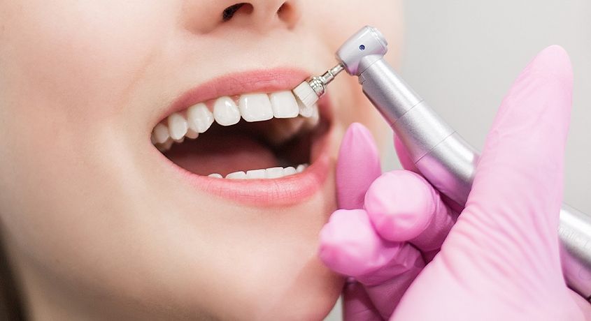 Бережное и эффективное удаление зубных отложений! Скидка 50% на комплекс УЗ чистки зубов + Air Flow от стоматологического кабинета «Трегубов».
