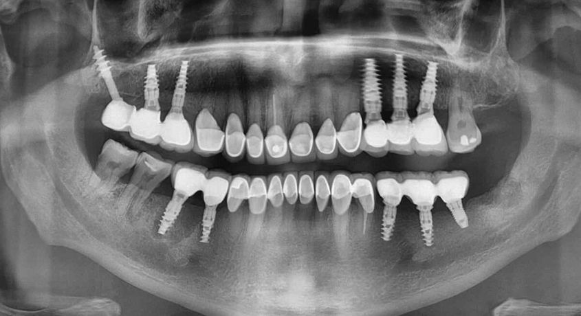 Скидка 50% на снимки зубов КТ, ОПТГ, ТРГ в стоматологической клинике Oxford Smile