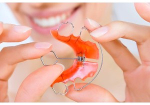 Починка ортодонтического аппарата