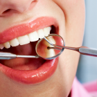 Лечение пульпита 4 канального зуба