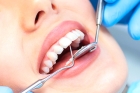 Бюджетное протезирование зубов