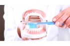 Услуги протезирования зубов металлокерамика