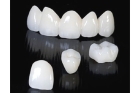Коронка на зуб из циркония в стоматологии