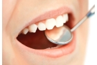 Реставрация сколов зубов