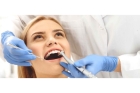 Шинирование в области 5-6 зубов