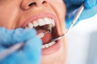 Лечение пульпита 2 канального зуба  