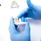 Удаление корней зуба