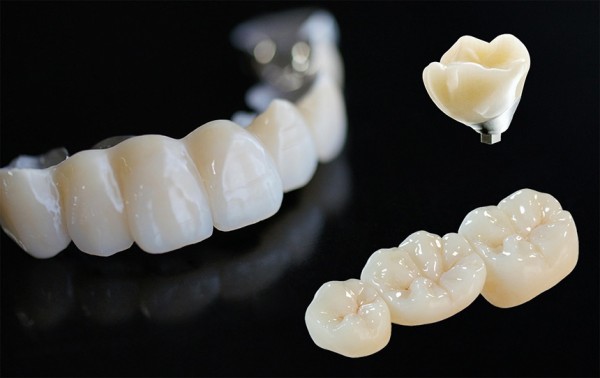 Металлокерамические коронки на зубы — недостатки и достоинства